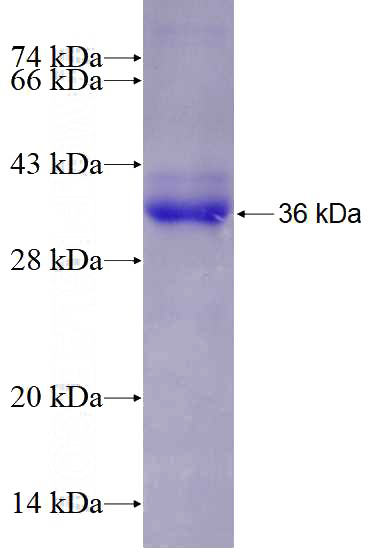 Recombinant Human SOCS6 SDS-PAGE