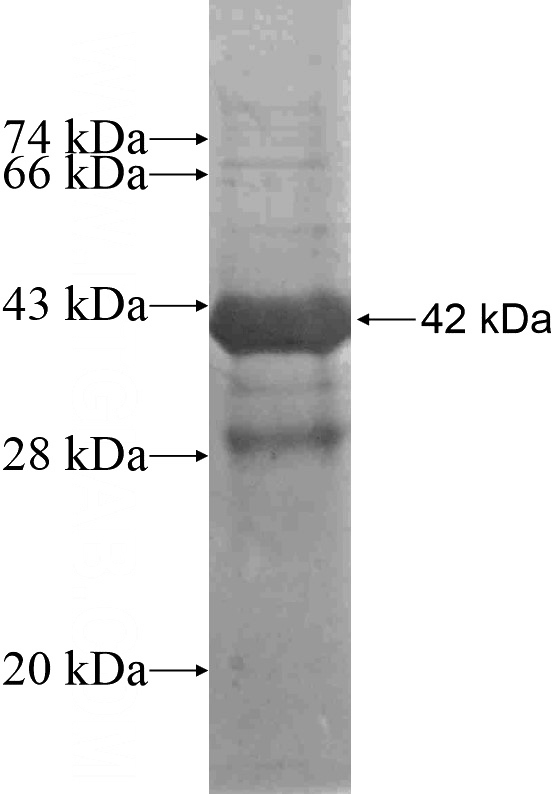 Recombinant Human CFLAR SDS-PAGE