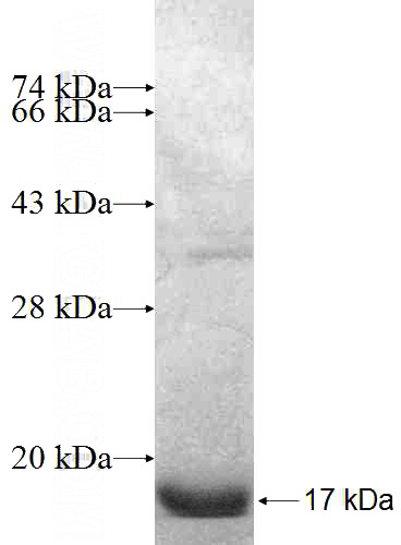 Recombinant Human MSMB SDS-PAGE