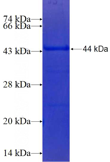 Recombinant Human TRPS1 SDS-PAGE