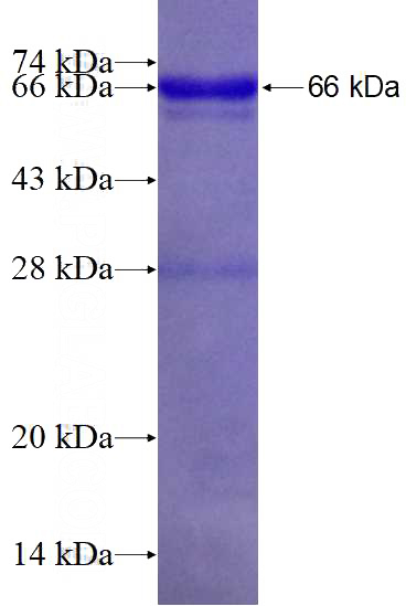 Recombinant Human RABEPK SDS-PAGE