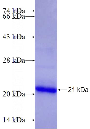 Recombinant Human ITGB3 SDS-PAGE