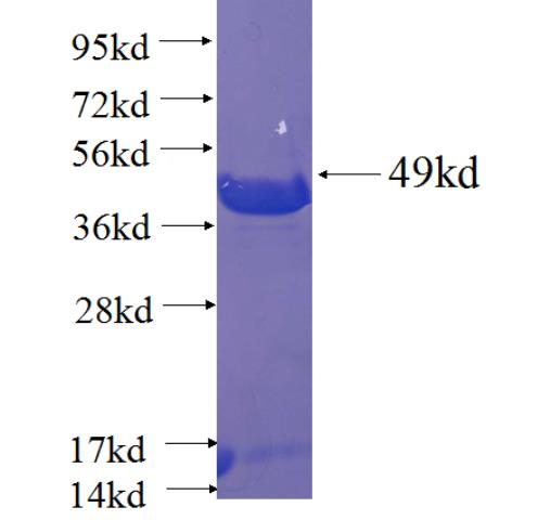 Recombinant human RGS4 SDS-PAGE