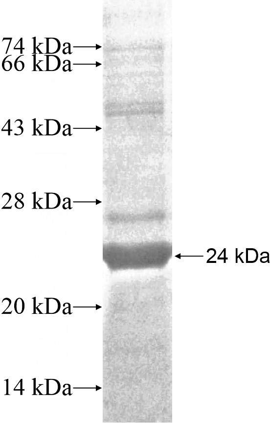 Recombinant Human CRYGN SDS-PAGE