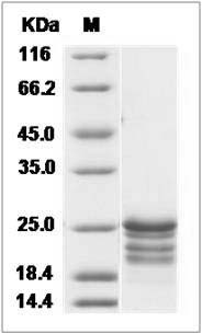 Human / Cynomolgus FGF16 / FGF-16 Protein SDS-PAGE