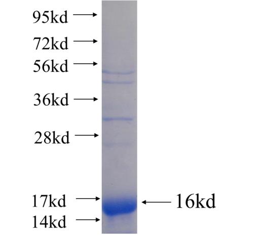 Recombinant human SLC37A2 SDS-PAGE
