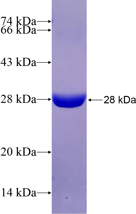 Recombinant Human STARD5 SDS-PAGE