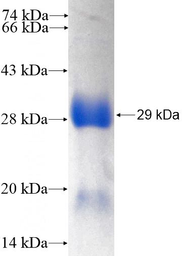 Recombinant Human PTPIP51 SDS-PAGE