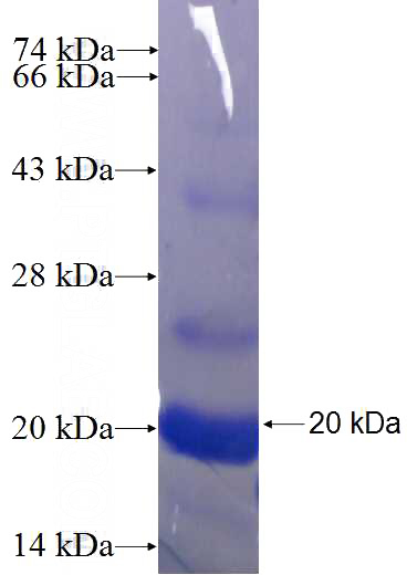 Recombinant Human LSM10 SDS-PAGE