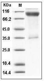 Human IL17RA / CD217 Protein (His & Fc Tag) SDS-PAGE