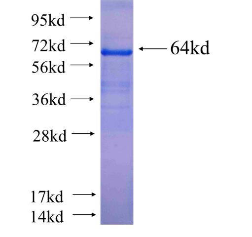Recombinant human MICAL1 SDS-PAGE
