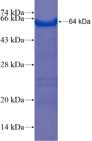 Recombinant Human PRPF39 SDS-PAGE