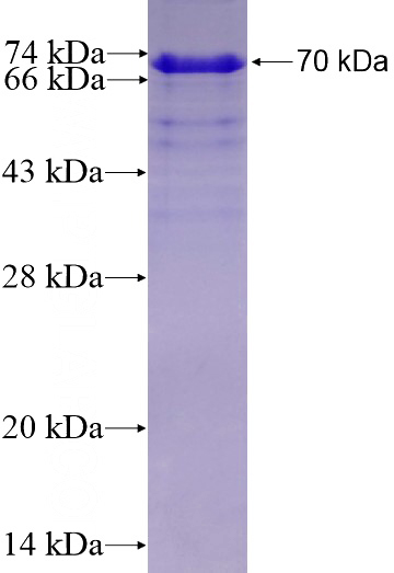 Recombinant Human TRA-1-60 SDS-PAGE