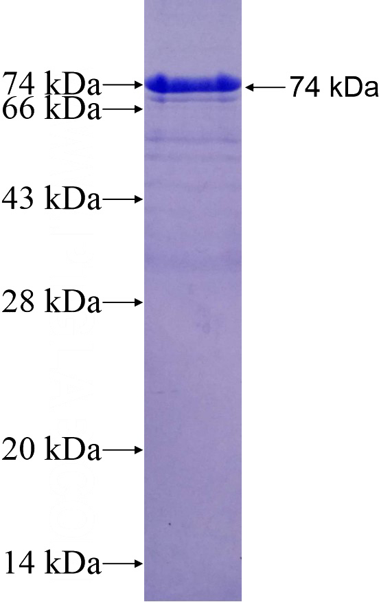 Recombinant Human USP20 SDS-PAGE