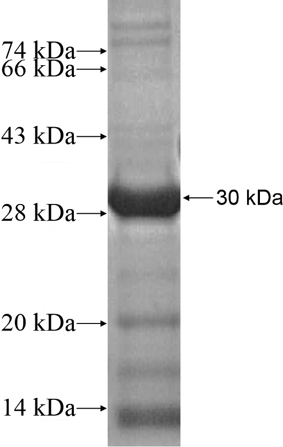 Recombinant Human ZNF560 SDS-PAGE