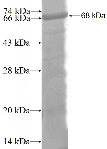 Recombinant Human MAGEA4 SDS-PAGE