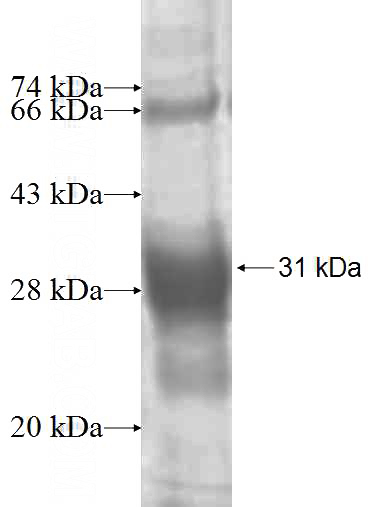 Recombinant Human HSD17B7 SDS-PAGE