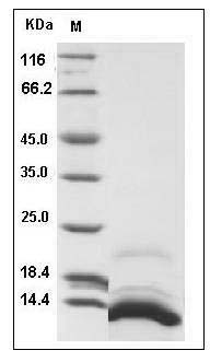 Human CXCL12 / SDF-1 Protein (isoform a, His Tag) SDS-PAGE