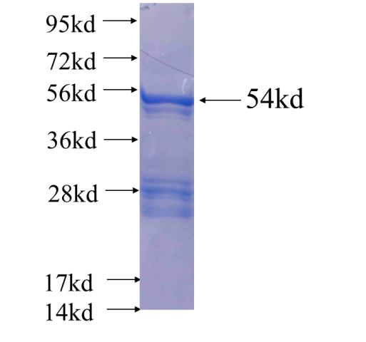 Recombinant human RAB26(Full length) SDS-PAGE