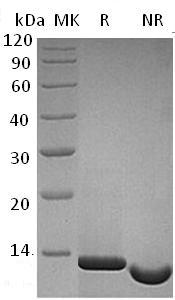 Human NGF/NGFB recombinant protein