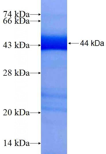 Recombinant Human TRIM62 SDS-PAGE