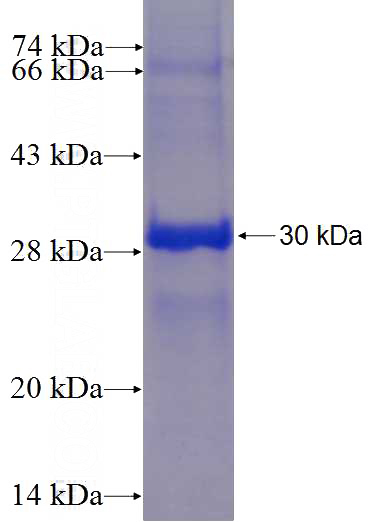 Recombinant Human SRMS SDS-PAGE