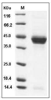 Mouse CD23 / FCER2 Protein (His Tag) SDS-PAGE