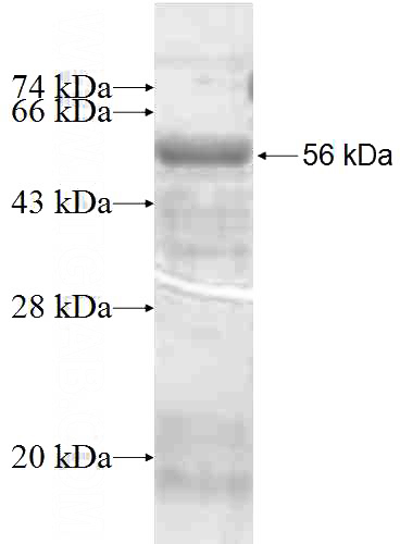 Recombinant Human SYK SDS-PAGE