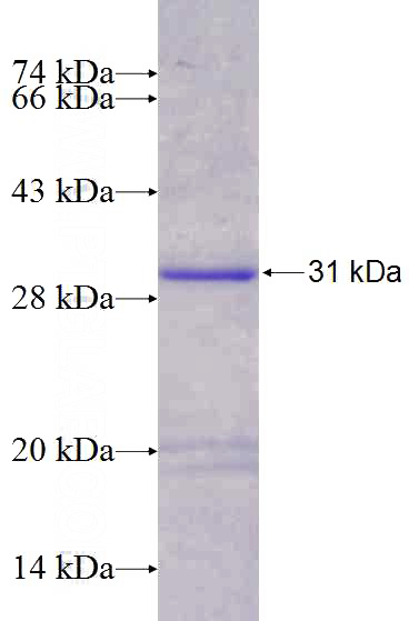 Recombinant Human OLAH SDS-PAGE