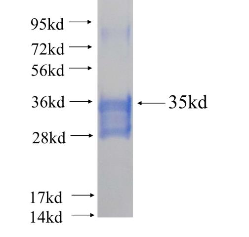 Recombinant human APLNR SDS-PAGE