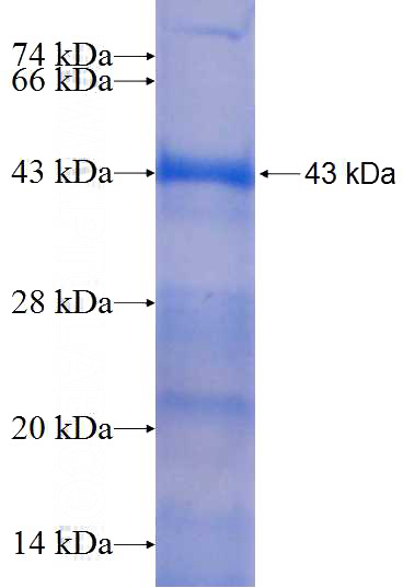 Recombinant Human ARSF SDS-PAGE