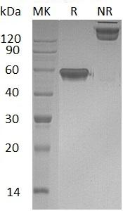 Human TNFRSF9/CD137/ILA (Fc & His tag) recombinant protein