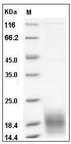 Human XCL1 Protein (His Tag) SDS-PAGE