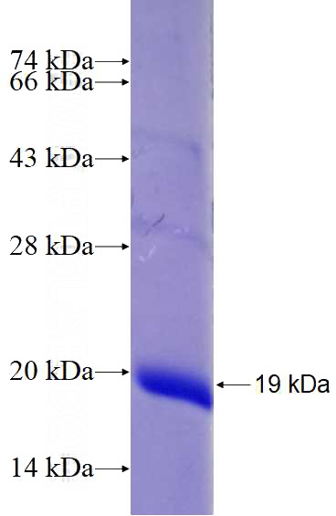 Recombinant Human JMJD3 SDS-PAGE