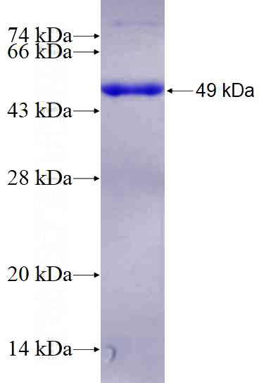 Recombinant Human RERG SDS-PAGE