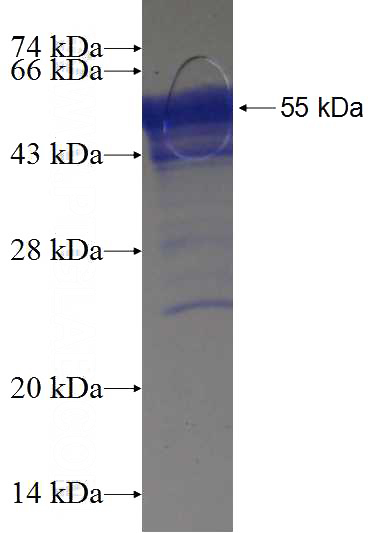Recombinant Human CCS SDS-PAGE