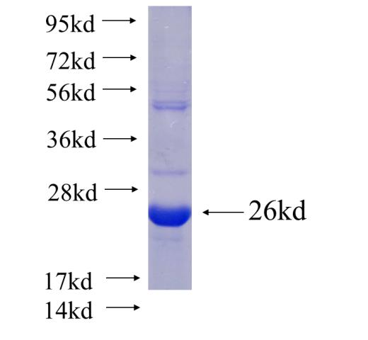 Recombinant Arabidopsis thaliana ClpT2 SDS-PAGE