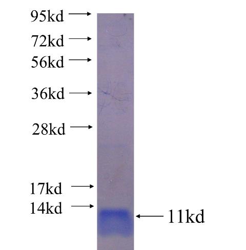 Recombinant human EIF4EBP3 SDS-PAGE