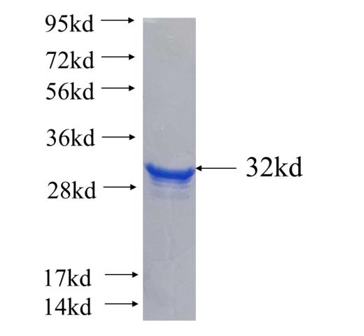 Recombinant human HOXB4 SDS-PAGE