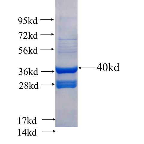 Recombinant human SRX1(Full length) SDS-PAGE