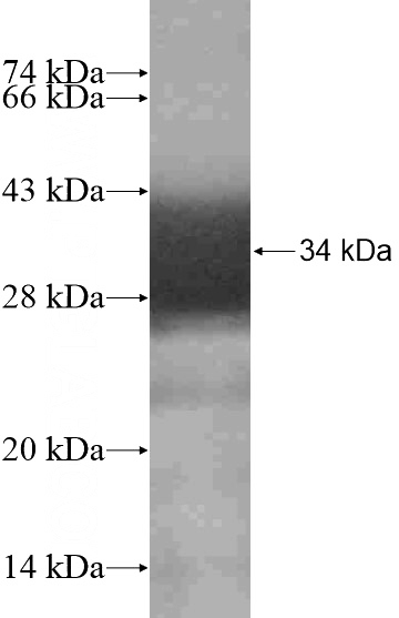 Recombinant Human WFDC12 SDS-PAGE