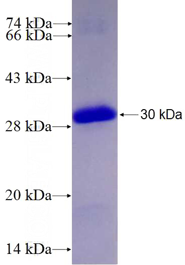 Recombinant Human TIGD3 SDS-PAGE
