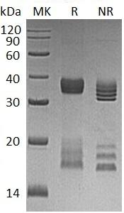 Human CGREF1/CGR11 (His tag) recombinant protein