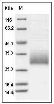 Mouse NKR-P1A / Klrb1a Protein (His Tag) SDS-PAGE