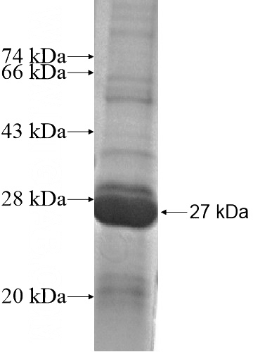 Recombinant Human ARL2 SDS-PAGE