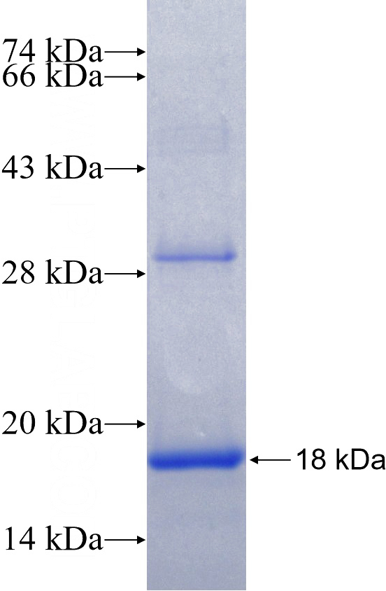 Recombinant Human SLC22A2 SDS-PAGE