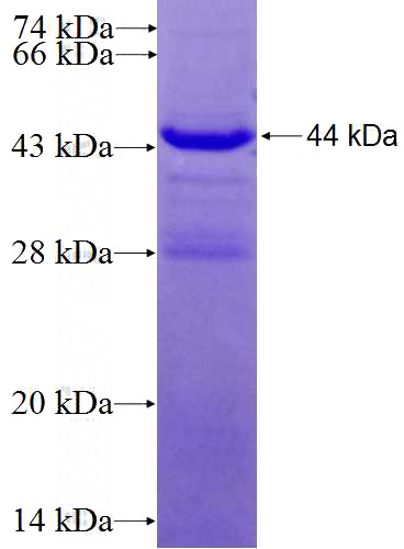 Recombinant Human RECQL SDS-PAGE