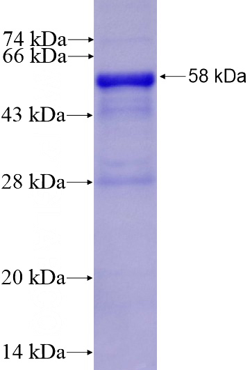 Recombinant Human SERPINB8 SDS-PAGE