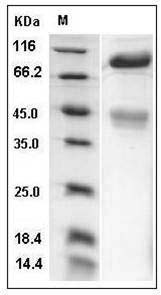 Mouse c-MET / HGFR Protein (His Tag) SDS-PAGE