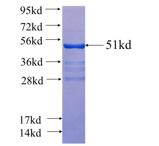 Recombinant human USE1 SDS-PAGE